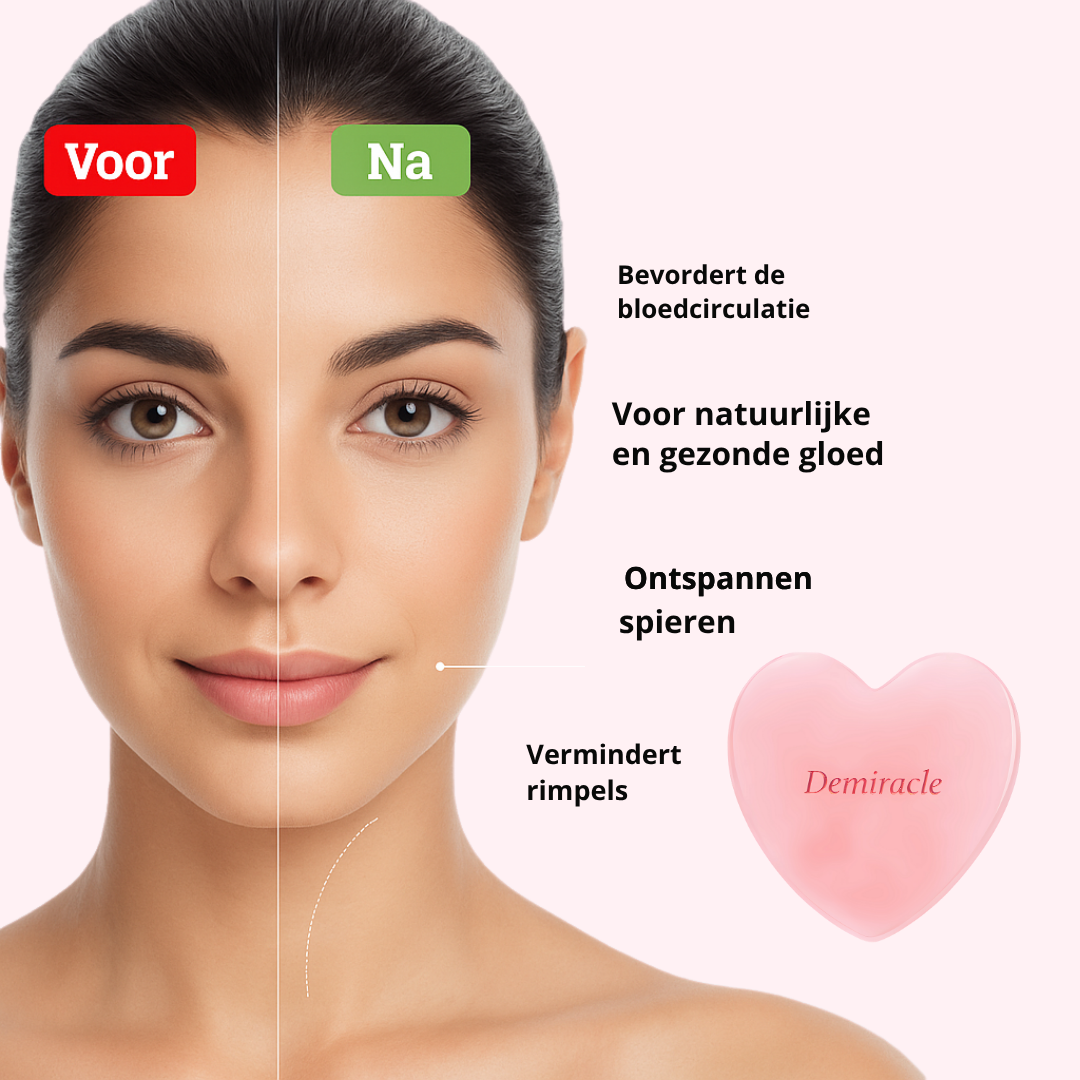 lang:NL